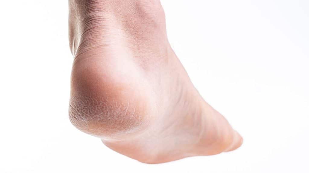 Foot Surgery Recovery Time & Healing Tips